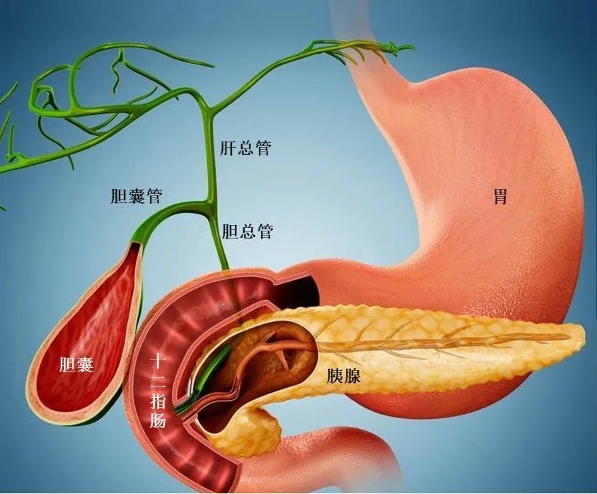胰腺微创手术丨丨寿光市中医医院普外二科成功实施ercp est胆总管取石